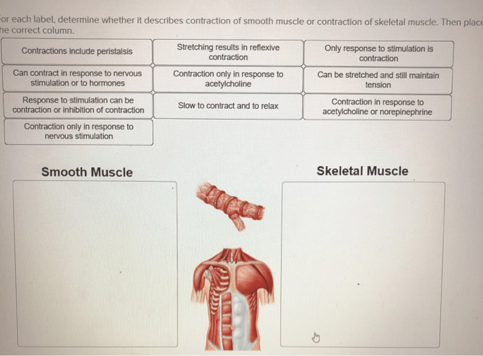 Determine whether each label describes skeletal or cardiac muscle